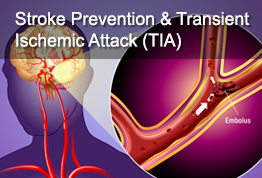 Stroke Prevention & Transient Ischemic Attack (TIA)
