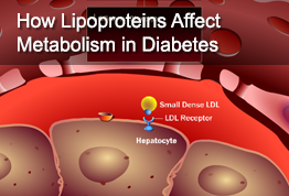 How Lipoproteins Affect Metabolism in Diabetes