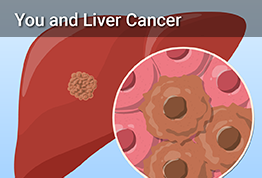 YouAndLiverCancer.com